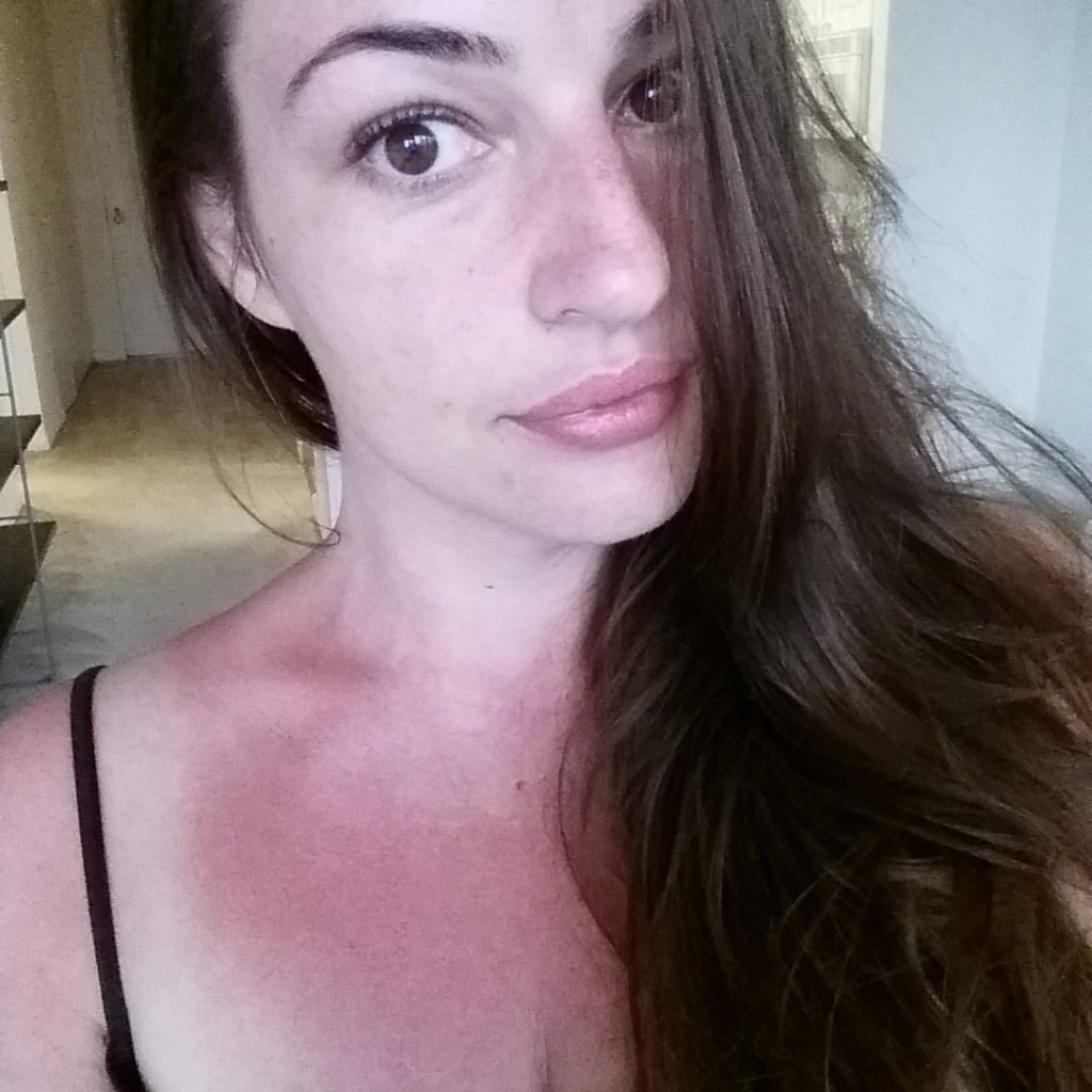 Check out that glorious sunburn